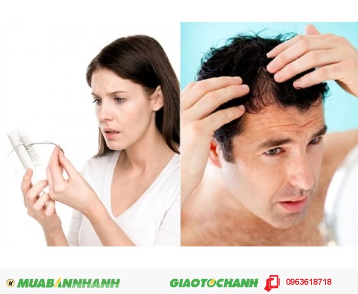 Sản phẩm thích hợp nhất cho những người bị hói đầu lâu năm, những người muốn kích thích tóc mọc nhanh, những người rụng tóc nặng, những người muốn bảo vệ tóc chắc khỏe hơn., 2