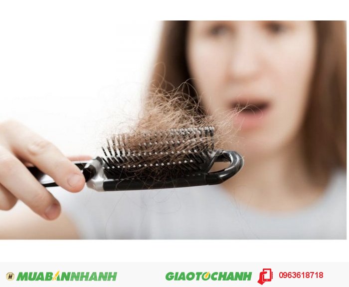 Tóc rụng nhiều hay tóc yếu luôn là nỗi lo không chỉ của phái đẹp mà cả đấng mày râu, điều này gây ảnh hưởng rất nhiều đến cuộc sống. Hair Revitalash được chiết xuất từ các thành phần thiên nhiên như trà xanh, nhân sâm,..cùng với công nghệ hiện đại từ Mỹ, chúng tôi tin sản phẩm này sẽ giúp bạn giải quyết những nỗi lo đó., 2