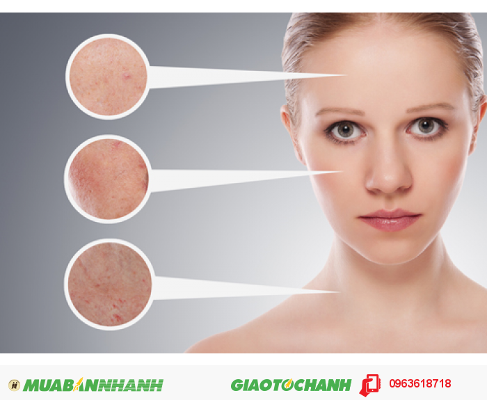 Ngoài ra, sản phẩm còn có thể giải quyết các vấn đề về nám da, tàn nhang, đồi mồi nhờ vào tính năng kìm hãm sự tổng hợp hắc tố da. Làm trắng da và nuôi dưỡng cho da đẹp mịn màng do ức chế enzyme làm điều kiện thúc đẩy quá trình hình thành sắc tố. Collagen cá 30.000mg hỗ trợ làm lành vết thương nhanh chóng, tăng cường lưu thông máu và bảo vệ xương chắc khỏe., 4