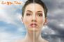 Trị nám tàn nhang bằng laser