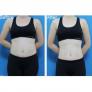 Giảm Mỡ Bụng Công Nghệ RF quận 6