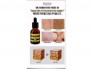 Serum kosxu trị mụn,trống nám. dưỡng da căng bóng,khoẻ mạnh.