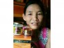 Kem trị nám tận gốc