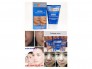 Vua Nám - Vua Trị Nám Photoshop Kpem Đã Xuất Hiện Tại Việt Nam ( Chính Hãng )