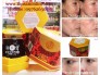 Vua Khử Nám Nhật Bản (Chính Hãng )