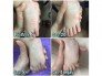 Dầu Thoa trị muỗi đốt