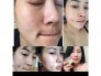 Kem dưỡng da cao cấp V10 của Skinaz Hàn Quốc