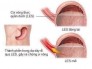 Sản phẩm giúp đặc trị dạ dày viêm loét dạ dày tá tràng khó tiêu.