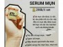 Trị mụn M'White