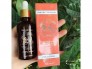 Đặc trị mụn thâm nám tàn nhang - cam kết ko hết hoàn tiền 100%