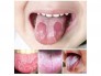Thuốc trị sâu răng