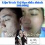 Kem Trị Mụn