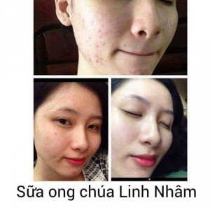 Sữa ong chúa linh nhâm