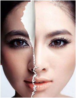 Điều trị nám dermajector -cách trị nám d