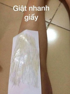 Combo triệt lông vĩnh viễn chỉ với một liệu trình duy nhất