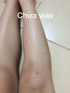 Combo triệt lông vĩnh viễn chỉ với một liệu trình duy nhất