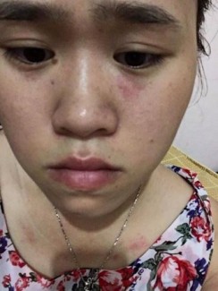 Sữa Rửa Mặt Thảo Dược Trắng Da Linh Nhâm