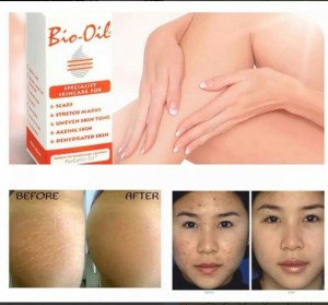 Tinh Dầu Bio-Oil Làm Mờ Sẹo, Thâm Nám, Vết Rạn Da
