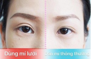 Combo Mí Lưới + Keo