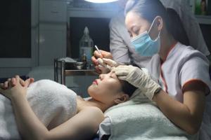 Lăn kim điều trị sẹo rỗ se khít chân lông bằng tinh chất purifiant tây ban nha