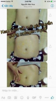 Vòng eo 56 - Kem tươi tan mỡ gia truyền