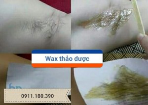 Tự triệt lông vĩnh viễn thủ công
