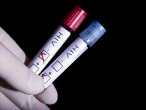 Chồng bị nhiễm HIV, làm thế nào để sinh con không bị nhiễm?