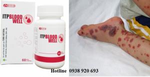 ITP Bloodwell hỗ trợ điều trị giảm tiểu cầu từ thảo dược