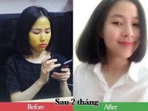 Kem gạo tinh nghệ mật ong