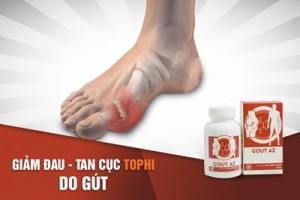 Gout AZ hỗ trợ giảm biến chứng do hạt tophi ở bệnh Gout