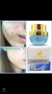 Kem trị mụn Linh Nhâm