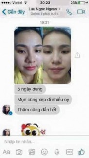 Kem trị mụn Linh Nhâm