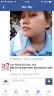 SỤN NÂNG MŨI 3D CAO CẤP HÀN QUỐC