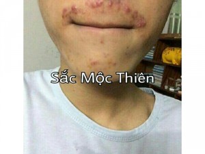 Sắc mộc thiên