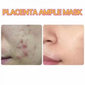 mặt nạ nhau thai cừu hàn quốc, mặt nạ nhau thai cừu, mặt nạ Placenta ample mask,