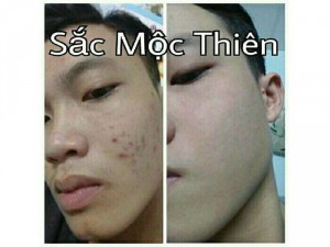 Sắc mộc thiên