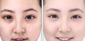 PA.Snow Kem Siêu Trắng Da Hoàn Hảo Giá Rẻ Nhất