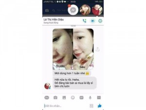 Serum thảo dược thiên thiên