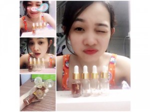 Serum dưởng da, bí quyết trị thâm mụn, nám, tàn nhang