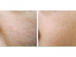 Serum 3in1