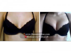 Estrogen cũng làm phát triển những tổ chức liên kết ở vùng ngực, đồng thời như một nhà đầu tư nó gọi các tế bào mỡ đến tạo dáng cho bộ ngực.