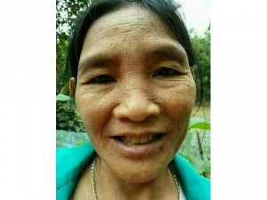 Kem trị nám tận gốc