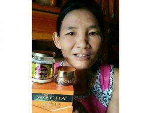Kem trị nám tận gốc