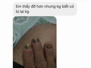 Hỗ trợ cho người bị nấm móng,lở,ngứa