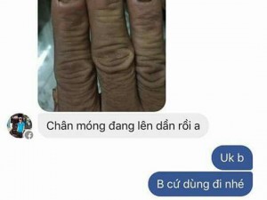 Hỗ trợ cho người bị nấm móng,lở,ngứa