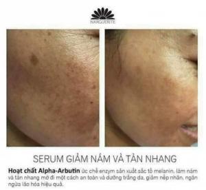 Serum nám, tàn nhang