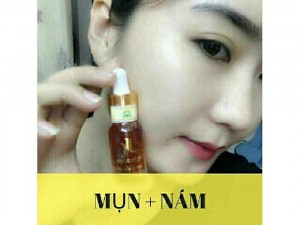 Serum thảo dược Kiều