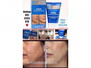 Vua Nám - Vua Trị Nám Photoshop Kpem Đã Xuất Hiện Tại Việt Nam ( Chính Hãng )