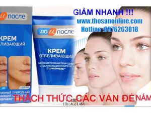 Vua Nám - Vua Trị Nám Photoshop Kpem Đã Xuất Hiện Tại Việt Nam ( Chính Hãng )