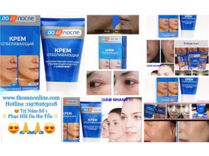 Vua Nám - Vua Trị Nám Photoshop Kpem Đã Xuất Hiện Tại Việt Nam ( Chính Hãng )